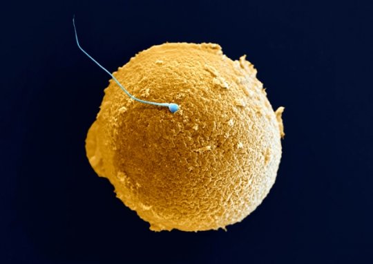 სქესობრივი უჯრედები: სპერმატოზოიდი და კვერცხუჯრედი