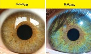 7 რამ, რასაც ჩვენი თვალის ფერის შეცვლა შეუძლია