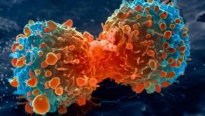 სიმსივნეები-ტიპები,მკურნალობის მეთოდები