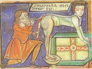 საშინელი სამედიცინო პროცედურები, რომლებსაც შუა საუკუნეებში ატარებდნენ