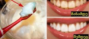 ქოქოსის ზეთი ნებისმიერ კბილის პასტაზე უკეთესი: 5 მიზეზი, რატომ უნდა გამოიყენოთ