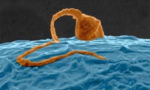 როგორ გამოიყურება მიკროსკოპის ქვეშ ჩვენი ორგანოები, კიბოს უჯრედების განადგურების პროცესი და ა.შ. (+ვიდეო)