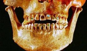 გარანტია ათასი წელი: უძველესი მაიას ტომის სტომატოლოგიის დონით მეცნიერები გაოცებული არიან