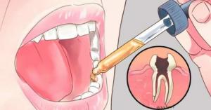 როგორ მოვიხსნათ კბილის ტკივილი წამში წამლის გარეშე