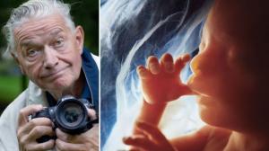 ჩასახვიდან - დაბადებამდე-24 ფოტო ლენარტ ნილსონის შემოქმედებიდან