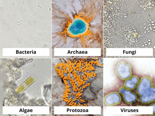 მიკრობები - მიკროორგანიზმები და მათი ტიპები