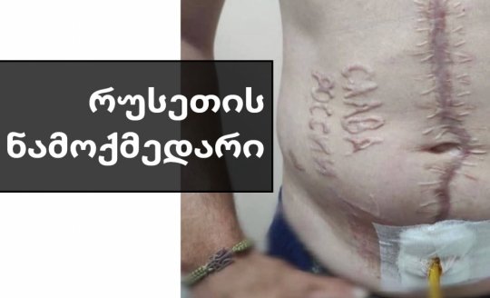 რუსებმა უკრაინელ ტყვეს სხეულზე „დიდება რუსეთს“ ამოატვიფრეს