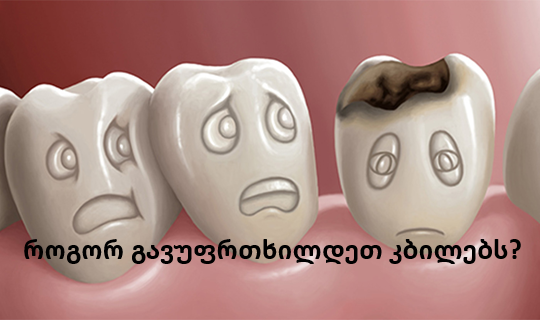 კბილები მნიშვნელოვანია! როგორ უნდა შევინარჩყნოთ ჯანმრთელი კბილები?