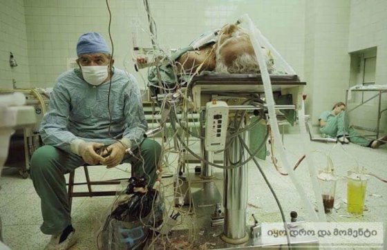 ექიმები 24 საათიანი გულის გადანერგვის ოპერაციის შემდეგ.