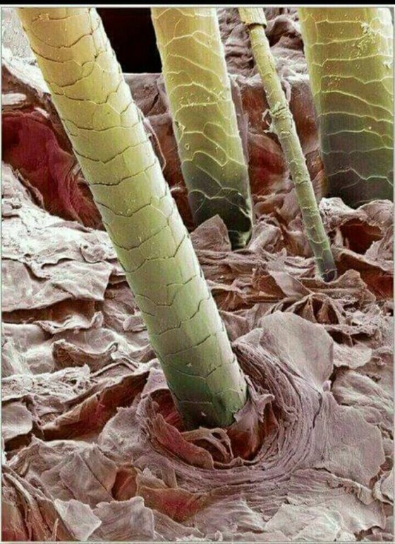 ასე  გამოიყურება ადამიანის თმები მიკროსკოპის  ქვეშ