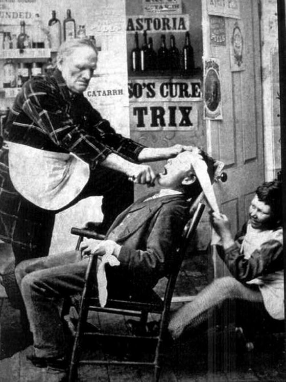 კბილის ამოღების პროცედურა - 1870 წელი