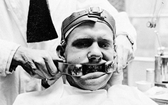სტომატოლოგია XX საუკუნეში